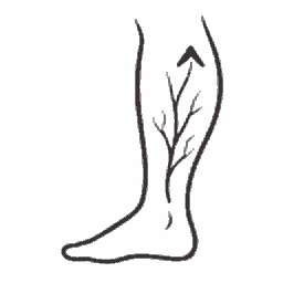 Spider and varicose vein support
